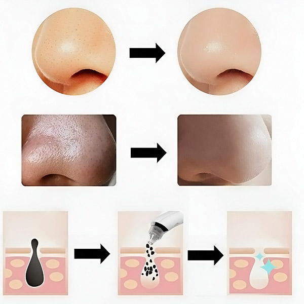 Udhëzime për përdorimin e KILPOR 2.0